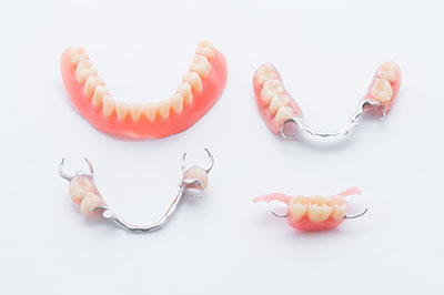 The image shows a collection of dental implants with a focus on upper front teeth, displayed against a white background.